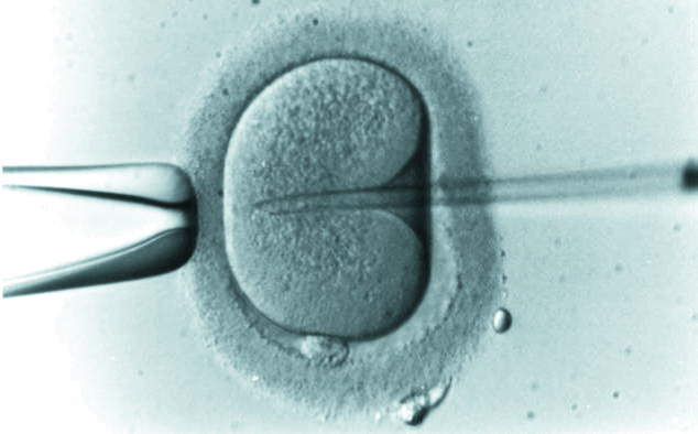 Fecundación in vitro en que consiste